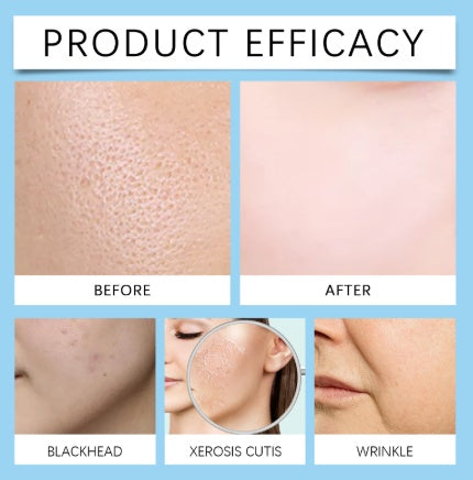 Jaysuing Hyaluronic Acid Roller Essence Improves Skin Pores, Hydrates And Moisturizes To Enhance Facial Gloss